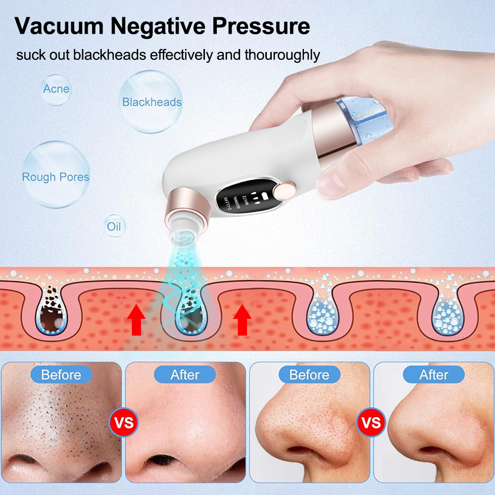 Blackhead Remover Electric Bla - Air Bubble Remover บทวิจารณ์และราคา